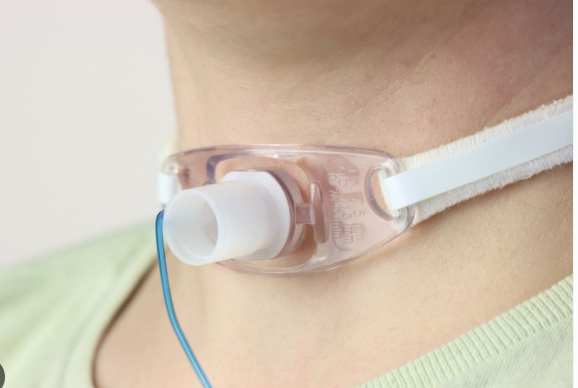 ASPIRAÇÃO DE VIAS AÉREAS